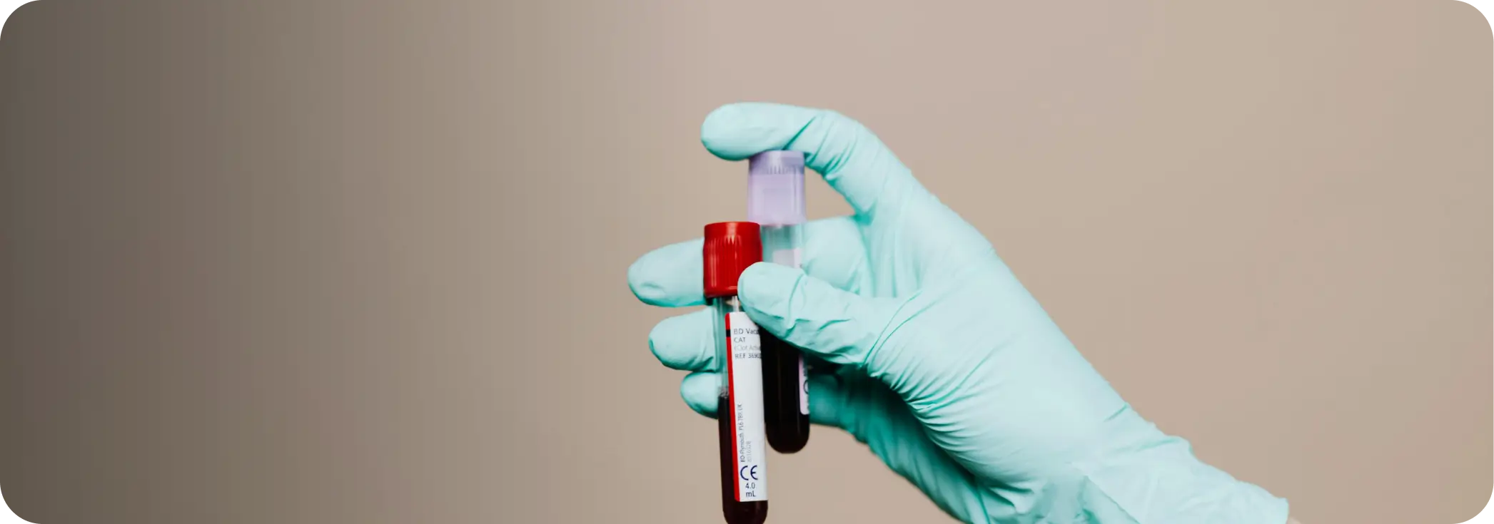 Fertility Testing in Sydney